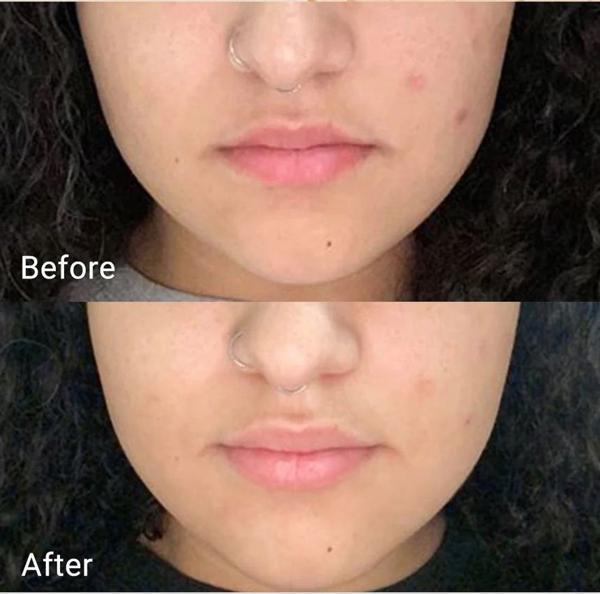 APRILSKIN - Real Calendula Peel Off Pack