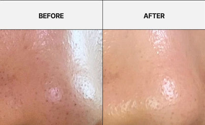 APRILSKIN - Carrotene IPMP Hydramelt Cleansing Balm