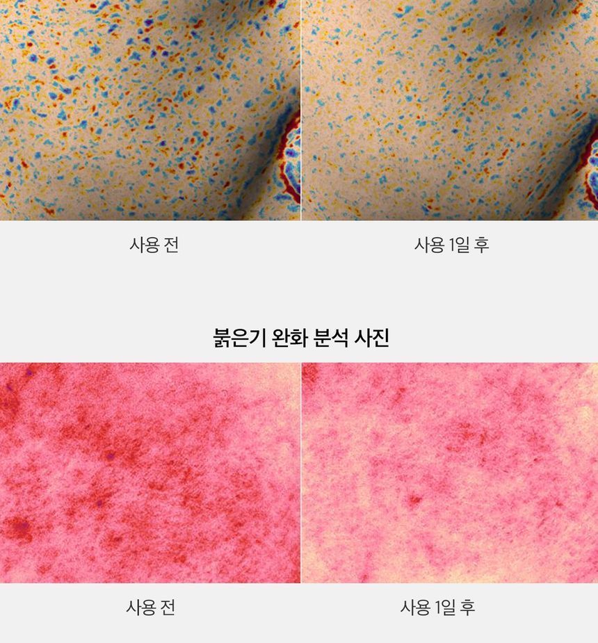 APRILSKIN - Carrotene IPMP Clearing Solution