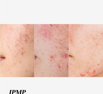 APRILSKIN - Carrotene IPMP Clearing Solution