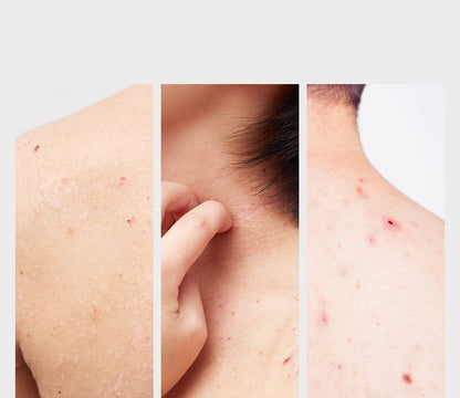 APRILSKIN - Carrotene IPMP Exfoliating Body Wash