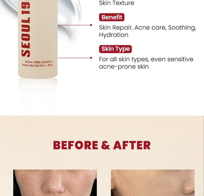 KSECRET - SEOUL 1988 Essence : Snail Mucin 97% + Rice