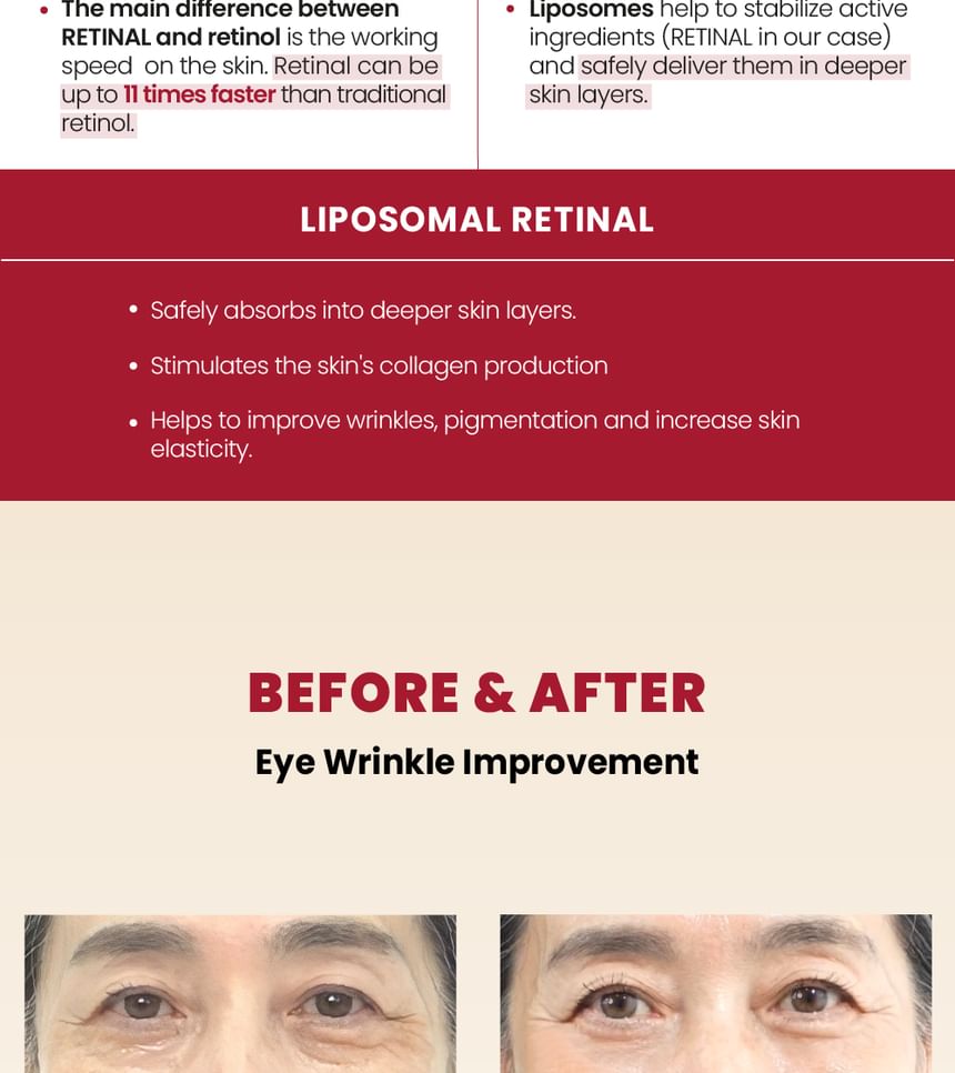 KSECRET - SEOUL 1988 Eye Cream : Retinal Liposome 4% + Fermented Bean