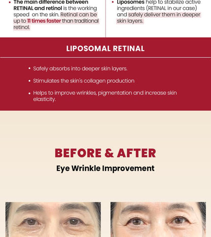 KSECRET - SEOUL 1988 Eye Cream : Retinal Liposome 4% + Fermented Bean