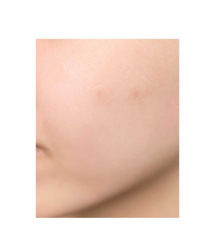 SKIN1004 - Spot Cover Patch